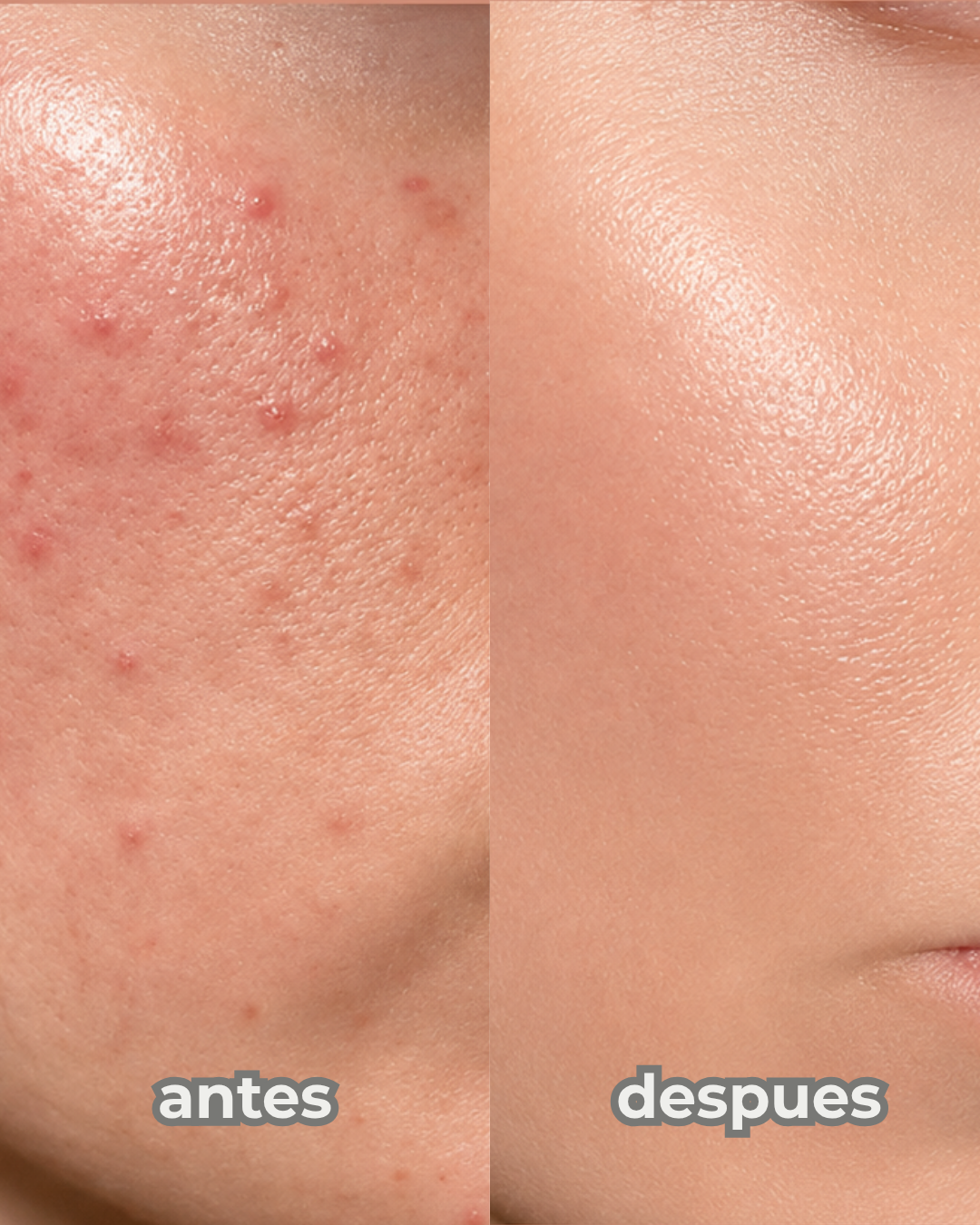 345 Relief Cream