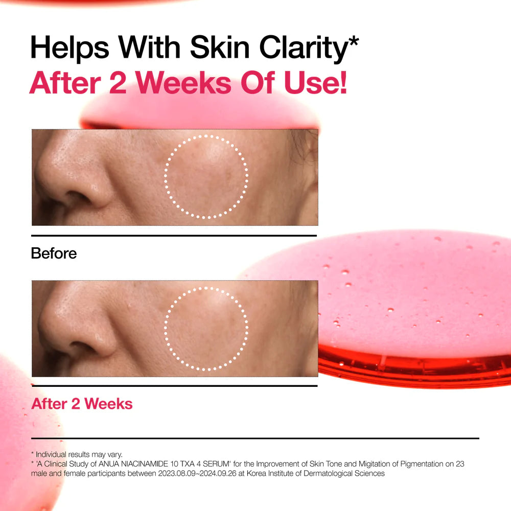 Niacinamide 10% + TXA 4% Serum 30ML